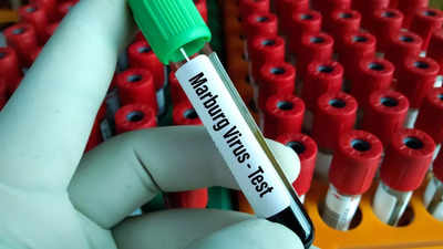 Marburg virus outbreak in Tanzania leaves 8 dead; warning symptoms to watch out for