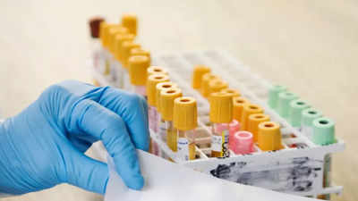 Blood test worth $949 screens for 50 different types of cancer! Know all about it