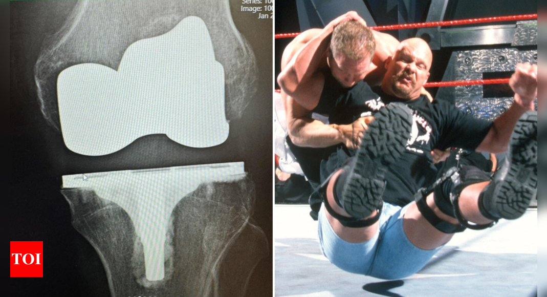 What Happened to Steve Austin? Inside the WWE Icon's Major Surgery