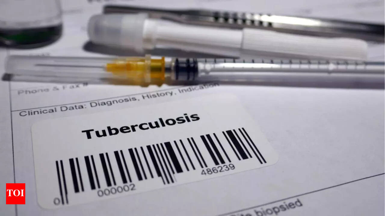 Kansas faces one of the largest TB outbreak in US history; warning signs and symptoms to know - The Times of India