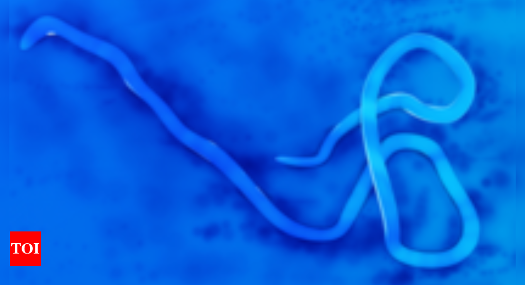 Hospital nurse dies in Uganda in first Ebola virus outbreak since 2022, health ministry says