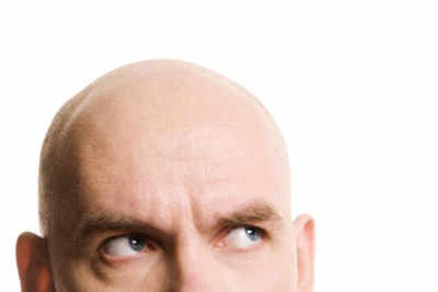 Does hair weaving really cure baldness?