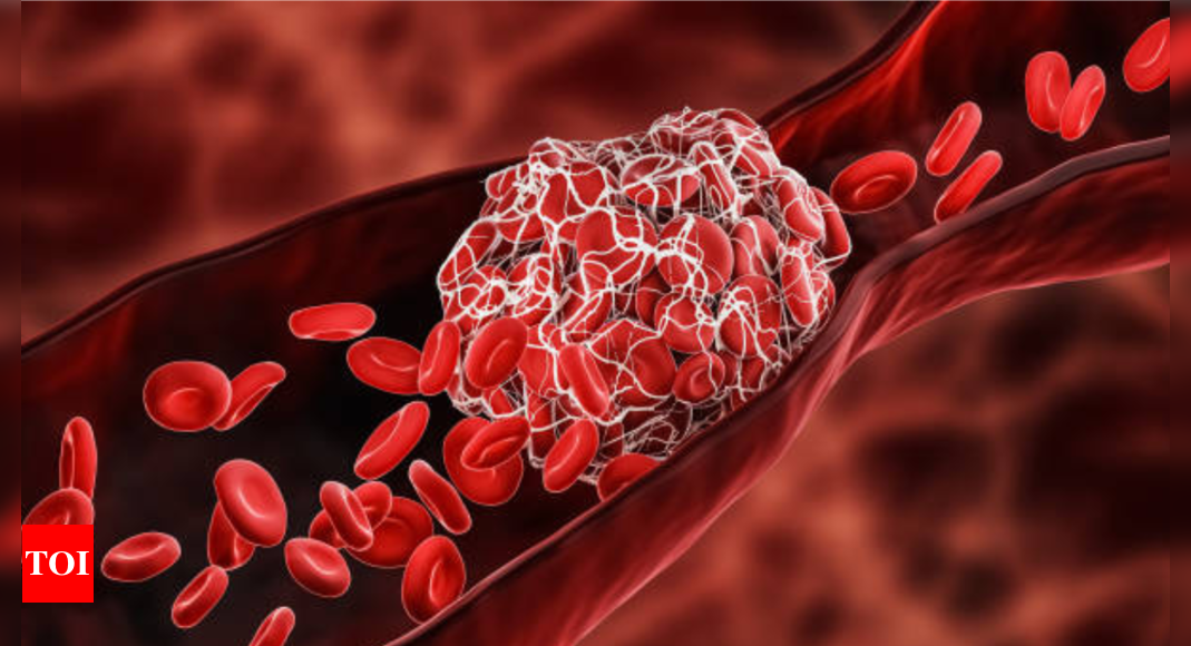 Which is the most common body part to get a blood clot (why is it so and how to avoid this)