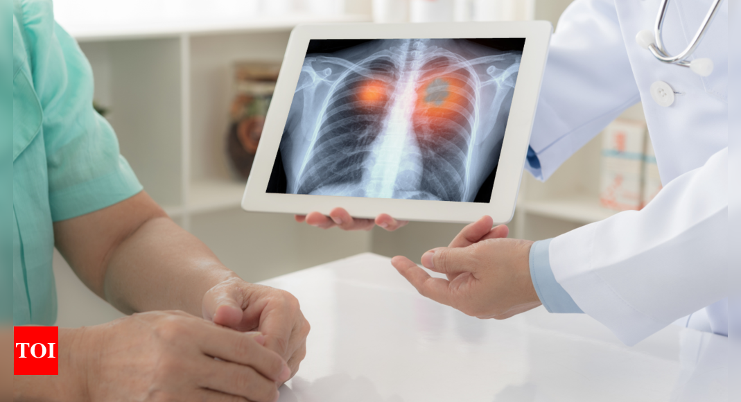 Why lung cancer is no longer just a smoker’s disease: Here's all you need to know