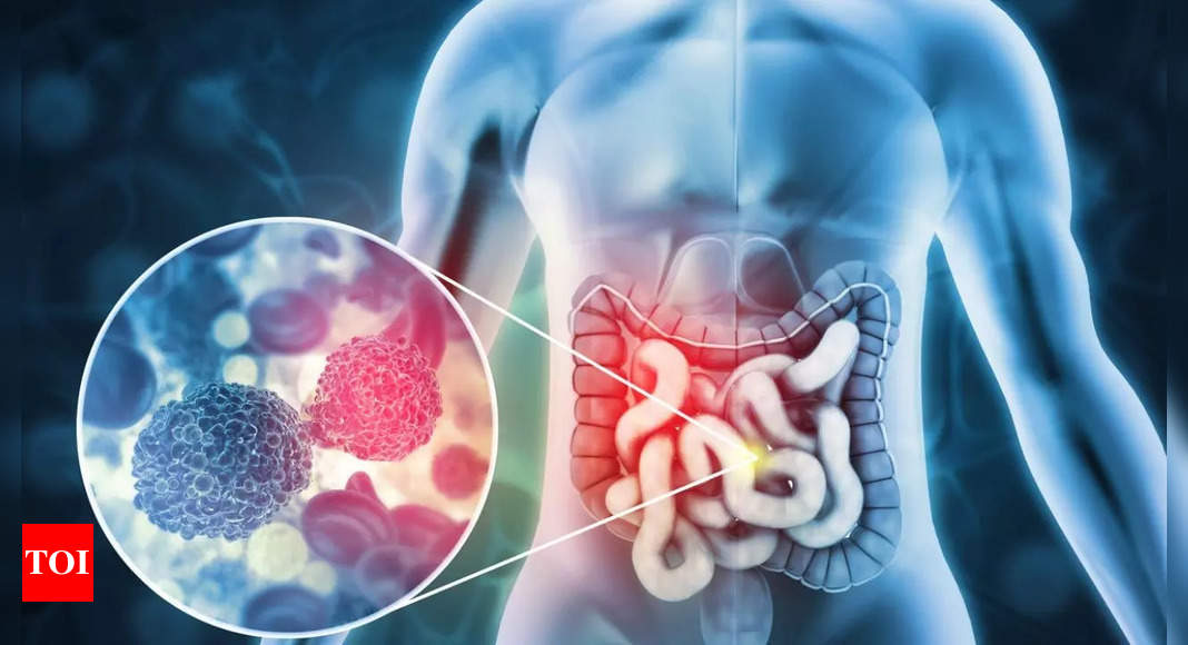 Medical miracle? Experimental drug wipes out colorectal cancer completely in trial