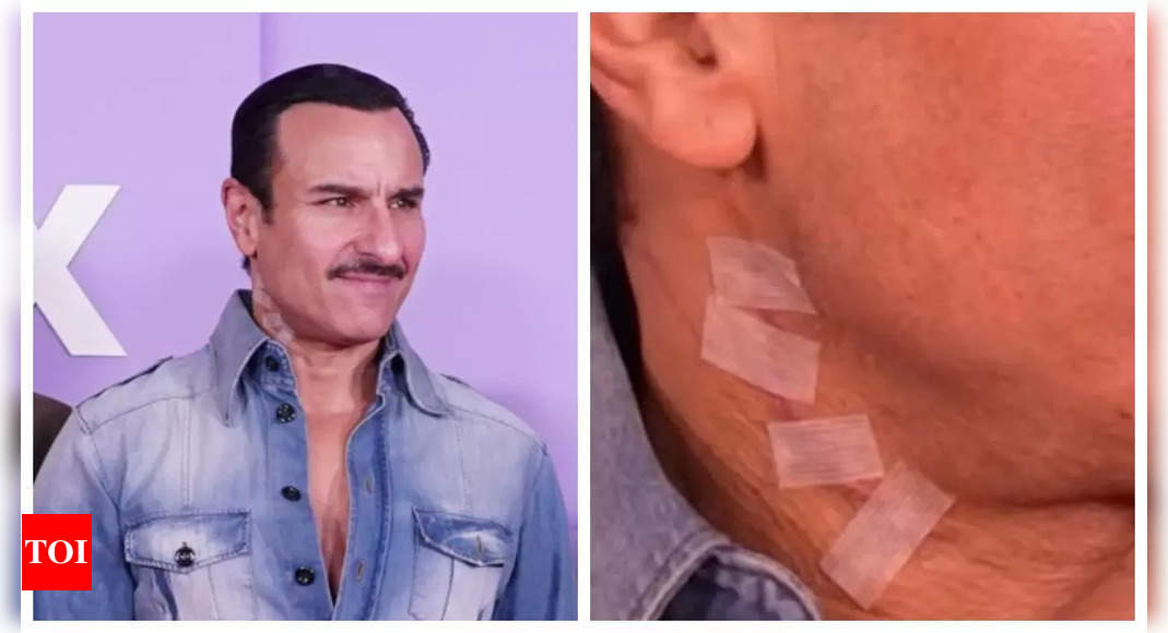 Saif Ali Khan's HUGE neck scar images go viral amidst claims that stabbing incident was a 'publicity stunt'