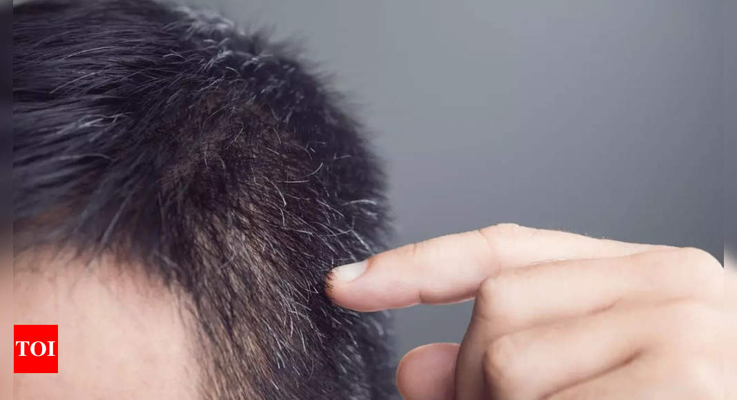 Anti-aging secret? This antioxidant can stop hair graying, discover scientists