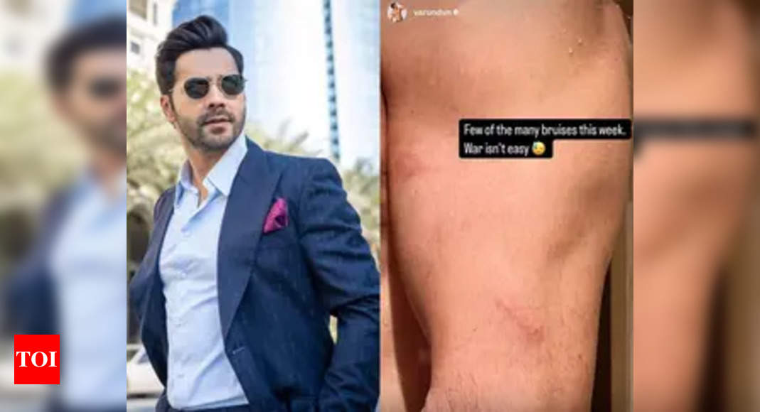 Varun Dhawan showcases 'few of the many bruises' he sustained