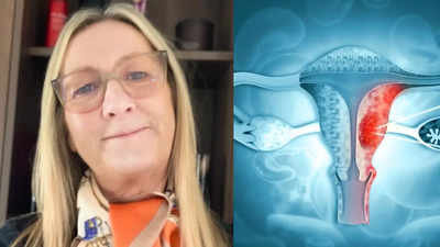 Menopause or cancer? 58-year-old woman ignores symptoms and receives a heartbreaking diagnosis