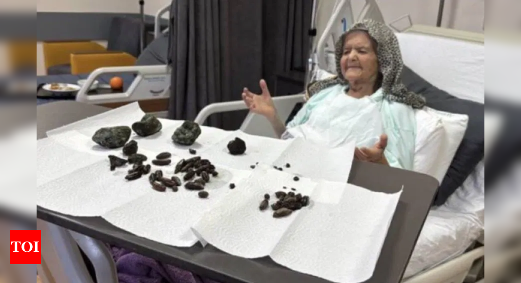 Doctors find 28 date seeds, 35 olive pits and 5 fist sized objects in 92-year-old's stomach