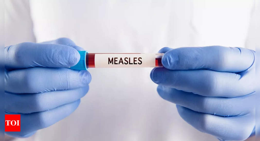 First measles death reported in Texas: Warning signs to watch out for