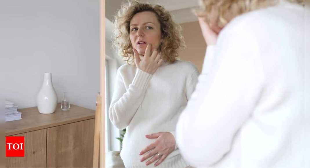 5 skincare issues every pregnant woman should be cautious about