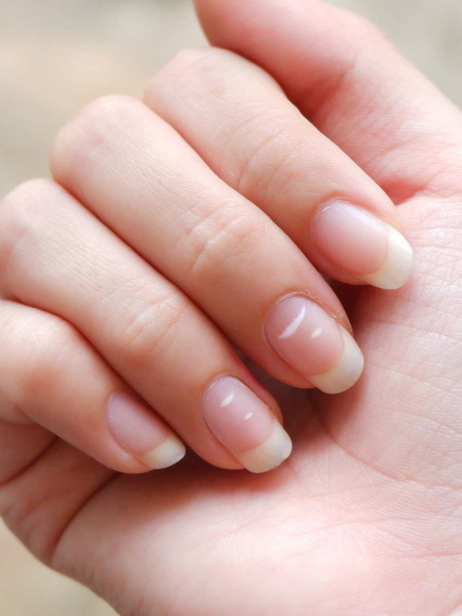 10 signs of vitamin and mineral deficiencies your nails warn you about ...