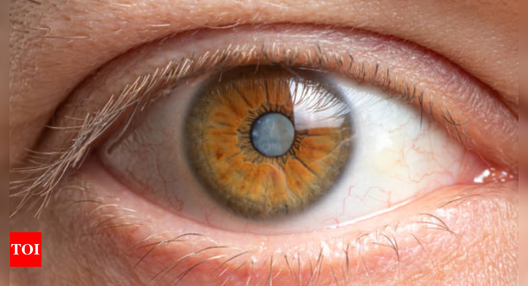 Cataracts and aging: How to maintain eye health as you age