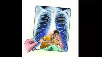 T gets national award for best performance in NAAT implementation in tuberculosis campaign