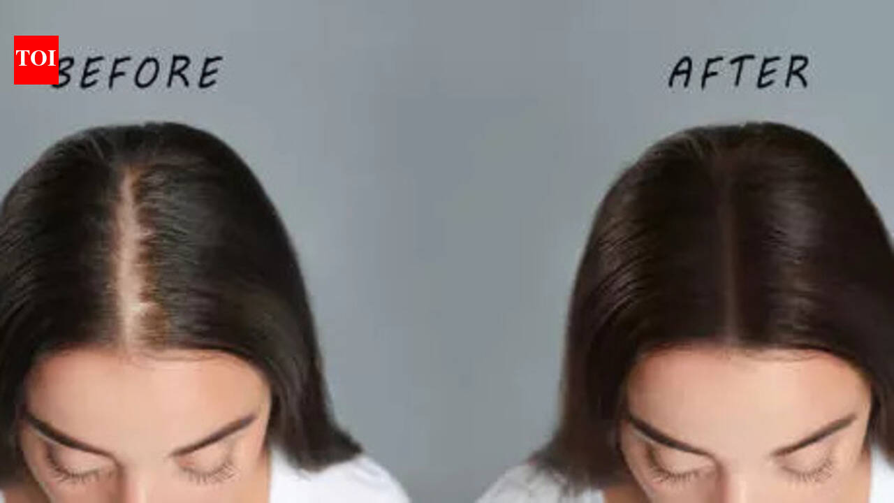 Hair Fall: 5 habits that can stop hair fall immediately
