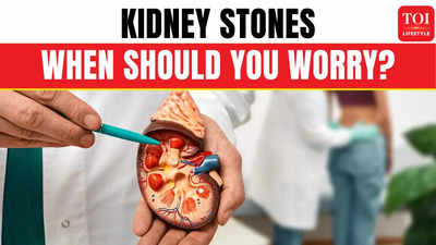 How To Know If You Have Kidney Stones? Expert Explains Symptoms & Signs