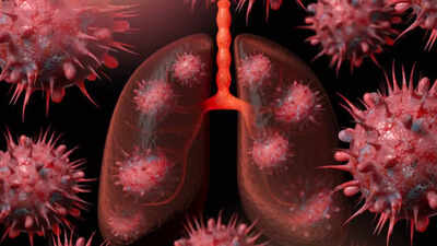 Teenager diagnosed with irreversible Popcorn Lungs: What is it? Symptoms,  causes, and how to stay safe - The Times of India