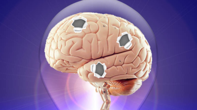 Creutzfeldt-Jakob Disease: The illness that creates holes in the brain