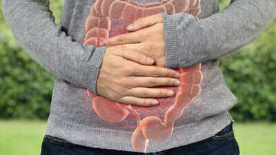Alarming rise in bowel cancer among the young: Surprising reasons fueling the surge