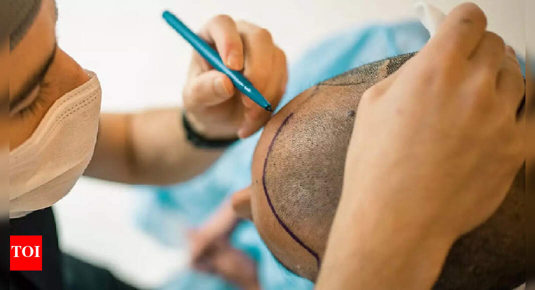 Another techie dies post hair transplant by same Kanpur doctor