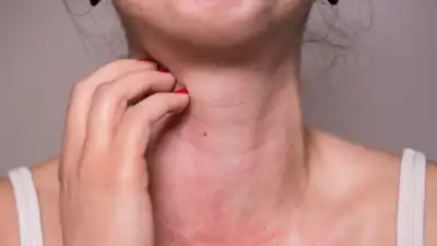 Are you allergic to some food? 5 ways to almost guess it at home without tests