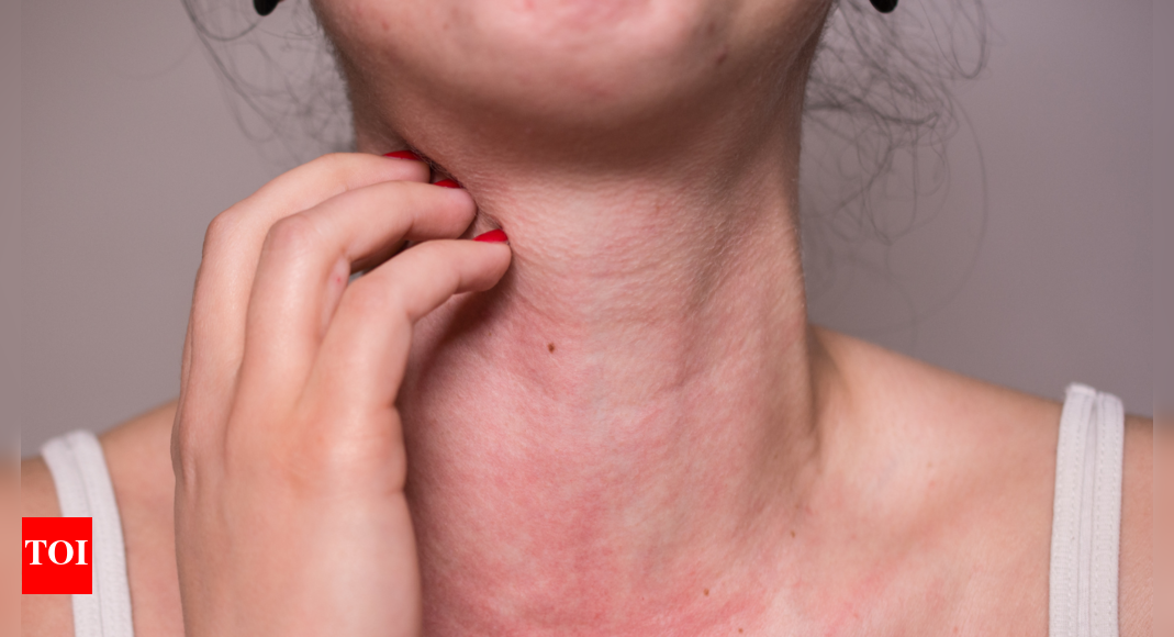 Identifying Food Allergies: At-Home Methods Explained