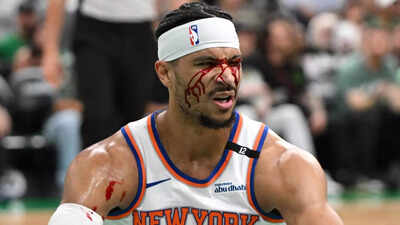 Josh Hart injury status for Indiana Pacers vs New York Knicks Eastern Conference Finals Game 2 (May 23, 2025)