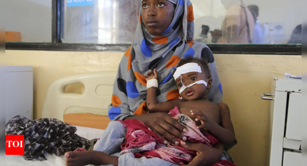 US Aid Cuts in Somalia Threaten to Worsen Malnutrition Crisis