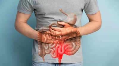Bowel cancer is rising rapidly in younger people: Causes and symptoms of the silent killer