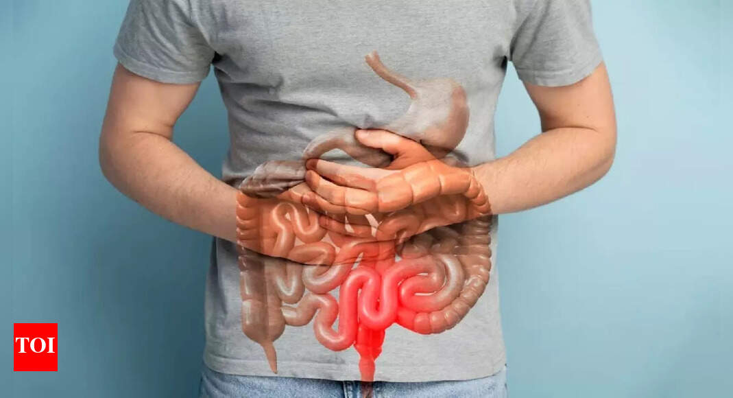 Bowel cancer is rising rapidly in younger people; What are the causes and symptoms of the disease?