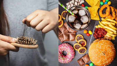 These day-to-day foods can silently cause hair fall