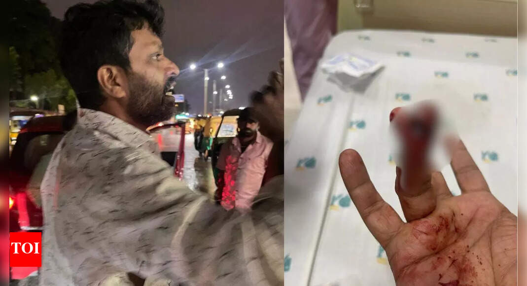 बेंगलुरो -रोड फ्यूरी: एक आदमी एक व्यवसायी की उंगली को काटता है, ऑपरेशन की लागत 2 लाख | बेंगलुरु न्यूज
