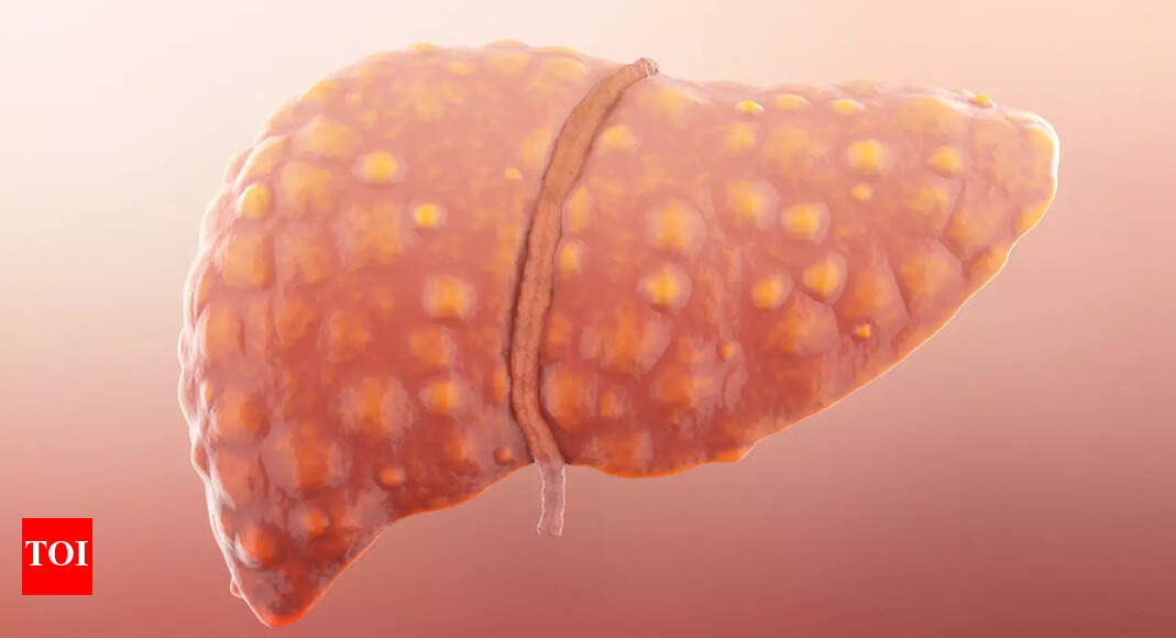 Study Explores Dietary Supplement for Liver Cirrhosis Treatment