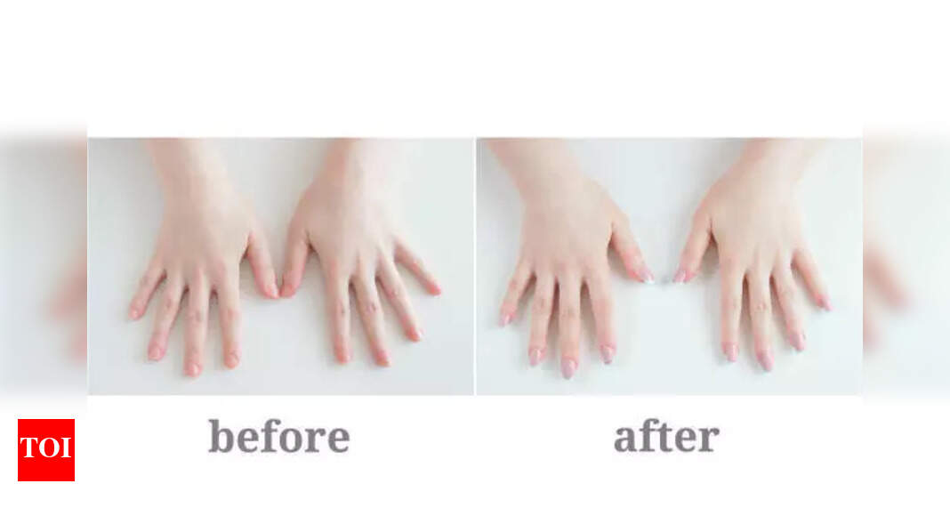 Growing Nails Naturally: Tips for Healthier and Stronger Nails