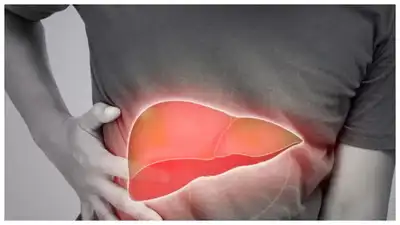 8 early signs of Liver Cancer that are easy to ignore