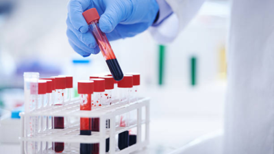  A blood test can detect early symptoms, finds study