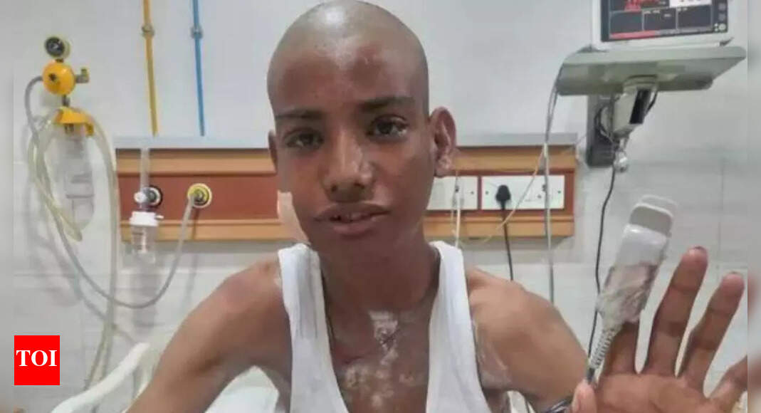 '1mm off, he could have died': Kota teen shot; bullet lodged in cheek for 5 days