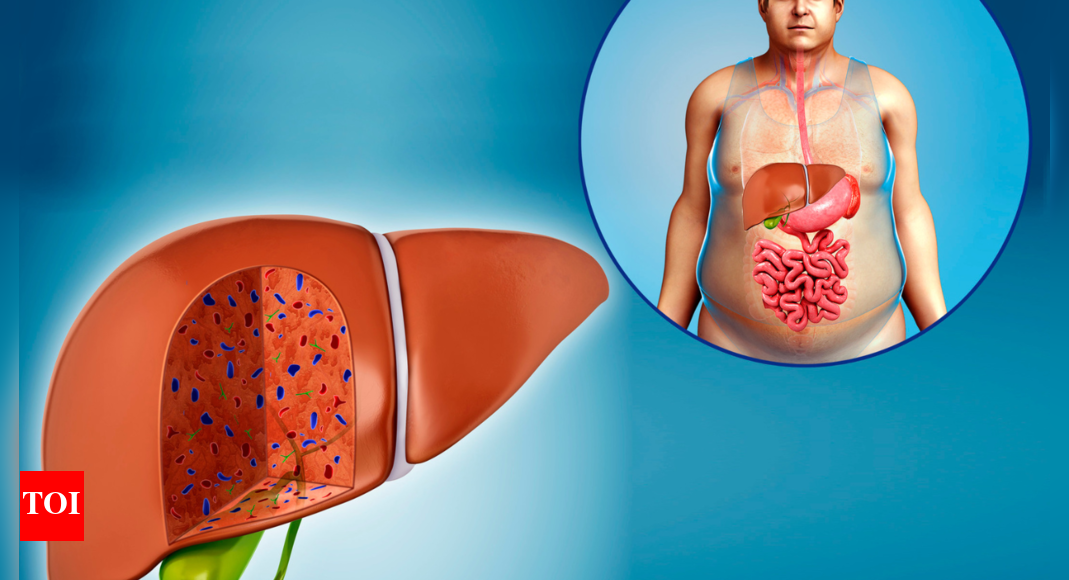 Fatty Liver: 5 drinks that can cure fatty liver | – Times of India
