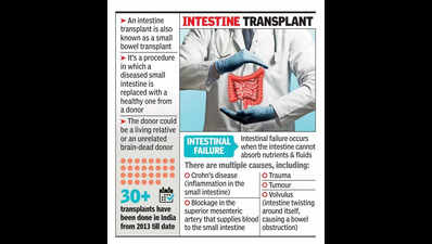 Man revived with just athird of donor intestine