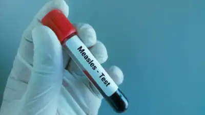  First case confirmed in young woman who was fully vaccinated