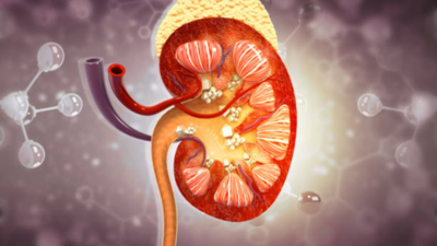 Kidney stone diet: What to eat and what to avoid