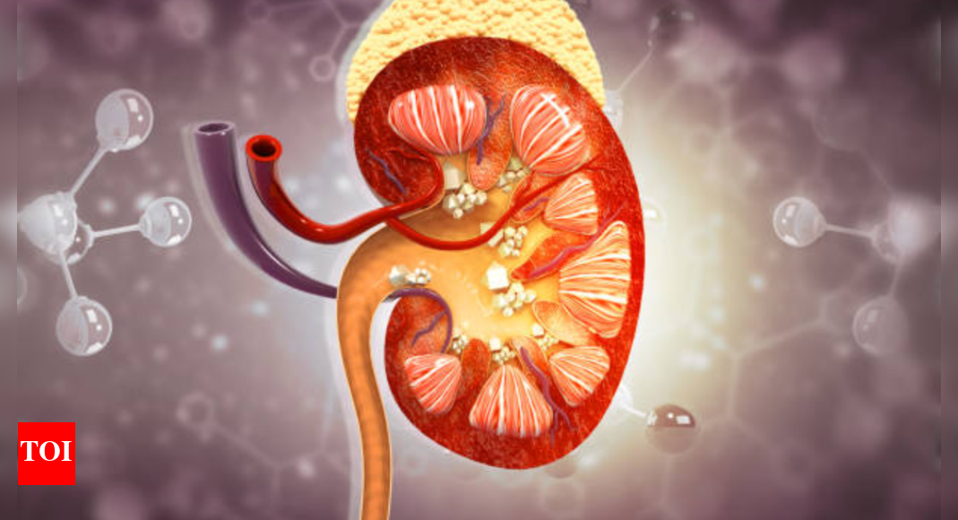 Kidney stone diet: What to eat and what to avoid – Times of India