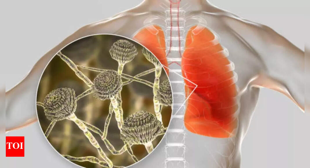 The Rising Threat of Aspergillus Fumigatus: A Deadly Fungus Invading the U.S.