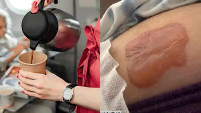 Scandinavian Airlines sued for $10 million after hot coffee spill burns 78-year-old woman mid-flight
