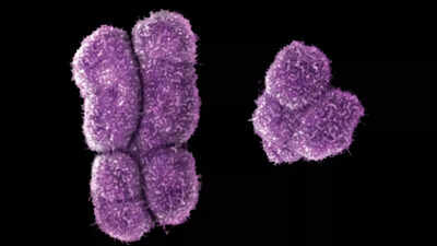 Men are losing the Y chromosome: What it means for men’s health and aging