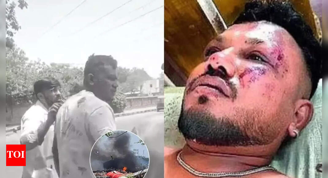 Ahmedabad plane crash: Lone survivor Viswashkumar Ramesh discharged from hospital