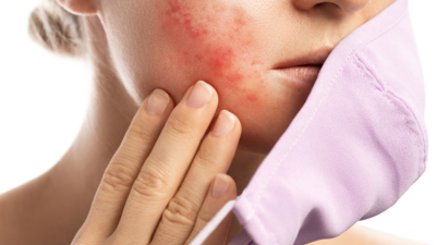 How to deal with sudden breakouts, fungal infections and scalp issues during rainy season
