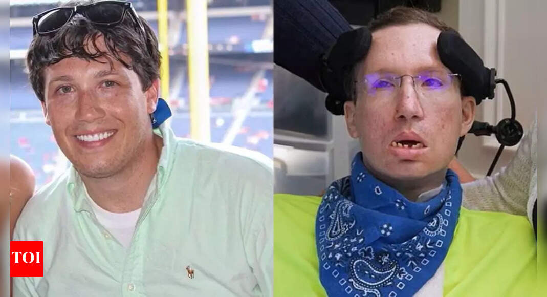 Neck adjustment gone wrong: Man in 20s left with shocking Locked-In ...