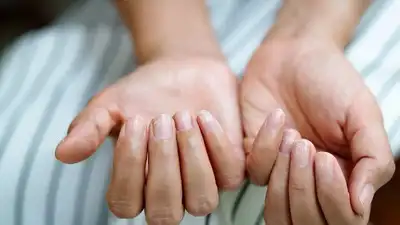 How to repair and strengthen nails after nail extensions